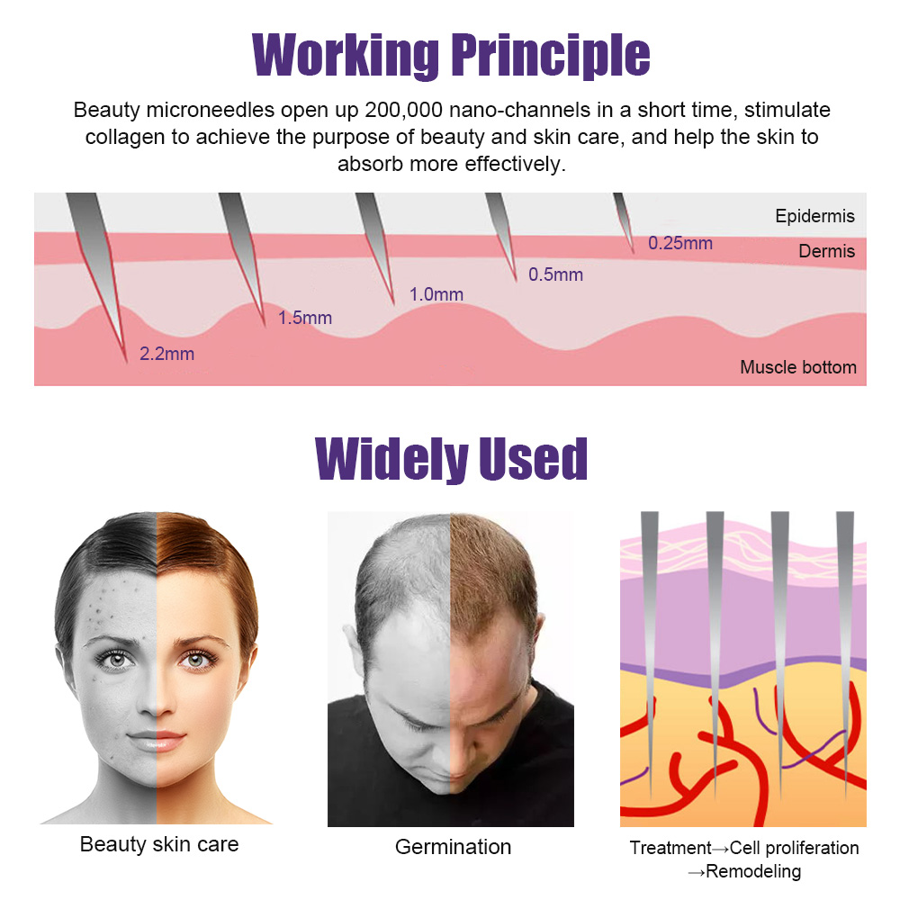 Natural Men Beard Growth Derma - Derma Roller 0.25 review and price