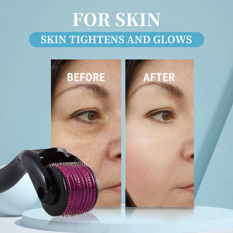 Professional 540 Roller Derma  - Derma Roller 0.25 review and price