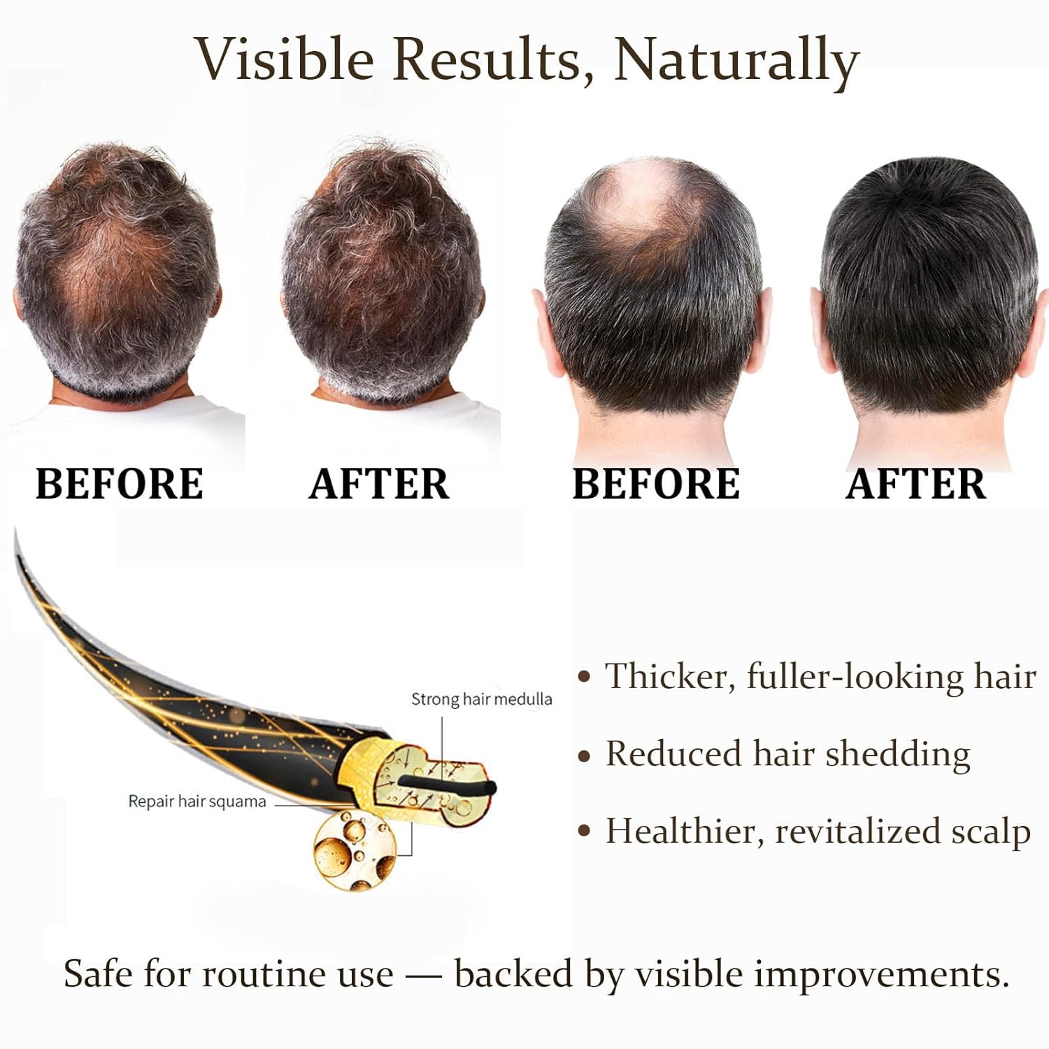 0.25mm Hair Care Micro-needle  - Derma Roller 0.25 review and price