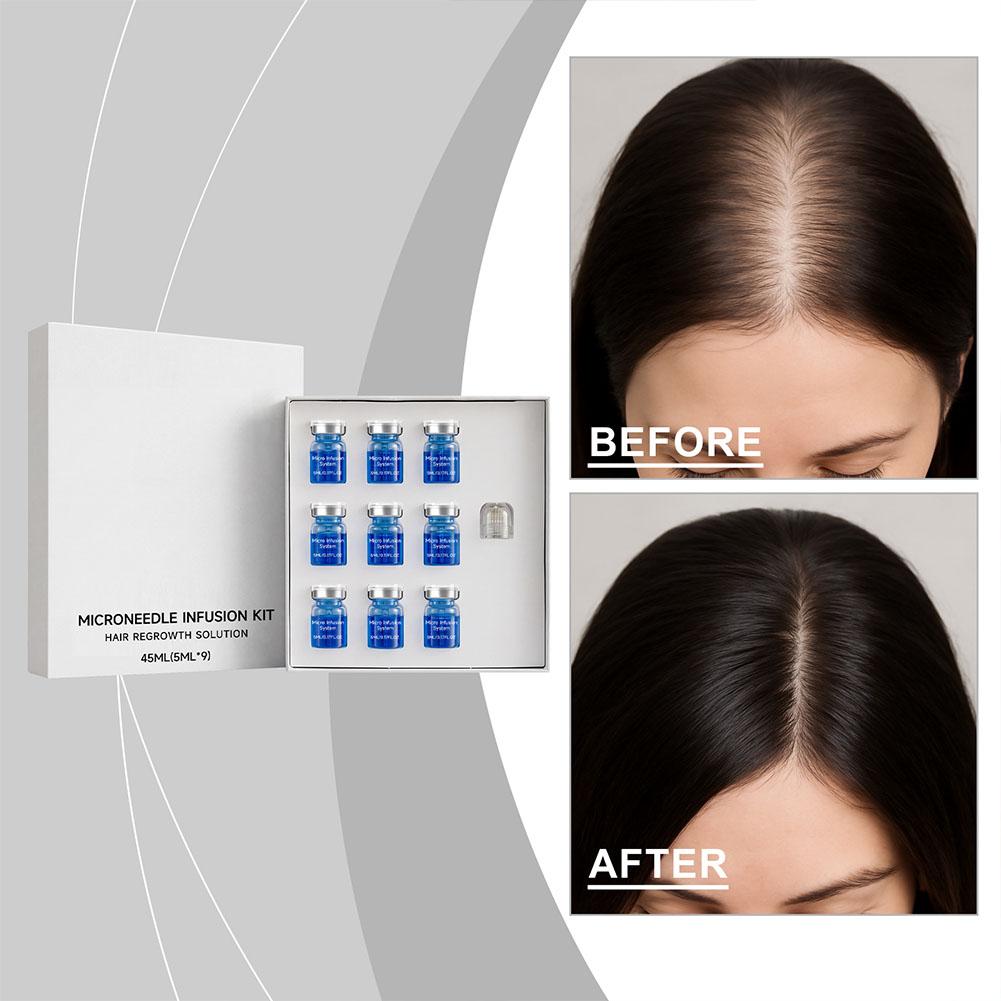 0.25mm Hair Essential Serum Mi - Derma Roller 0.25 review and price